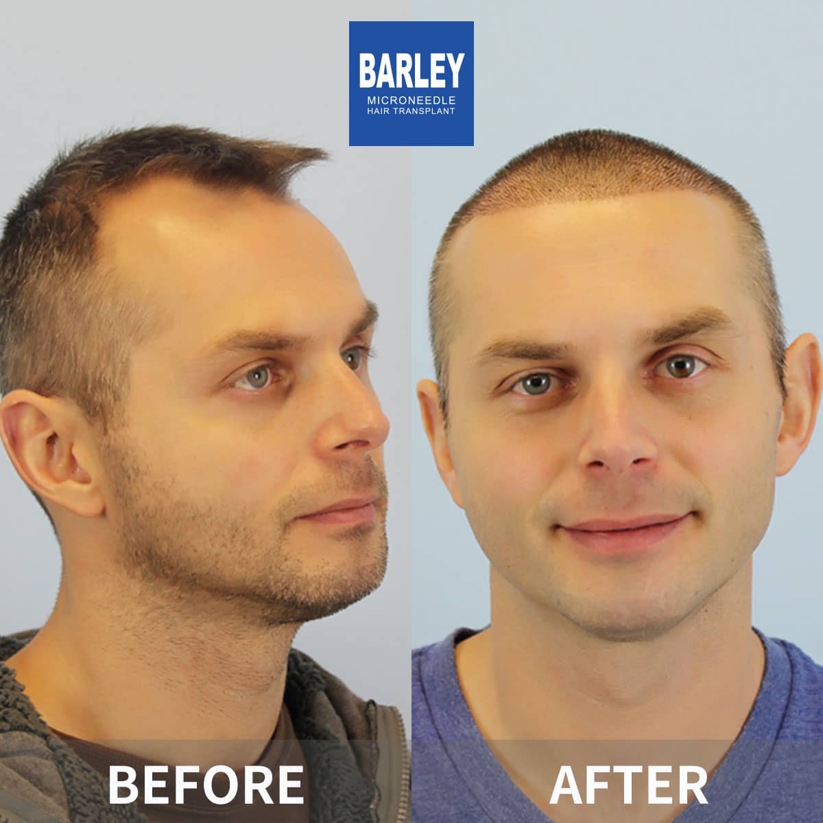 restoration hair results