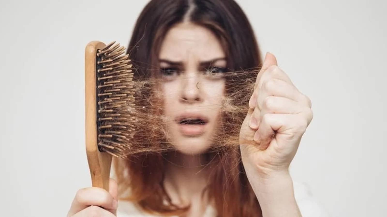 Is Hair loss Genetic?